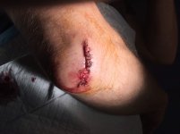 12 Stitches.jpg