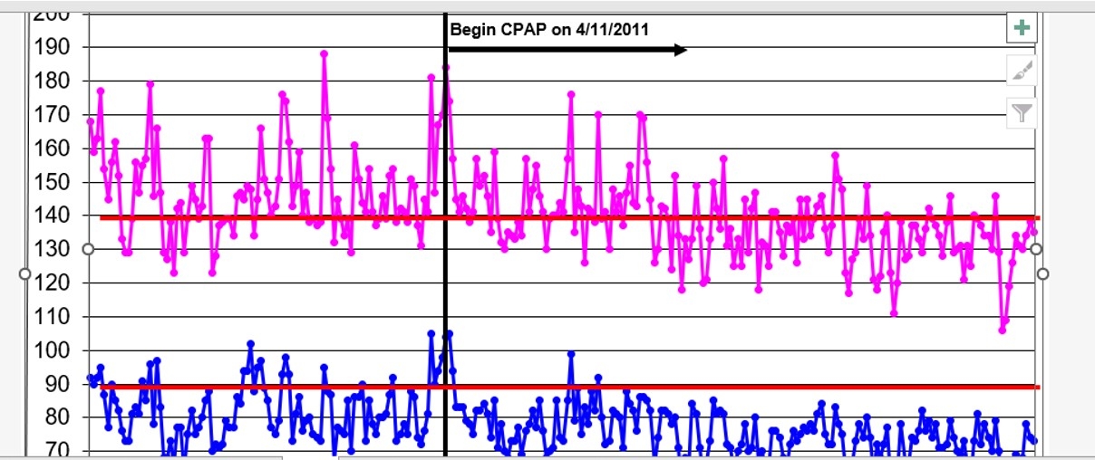 BP after CPAP.jpg