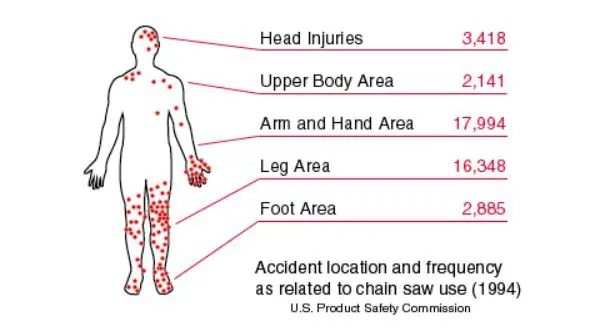 chainsaw injury statisticsx.jpeg