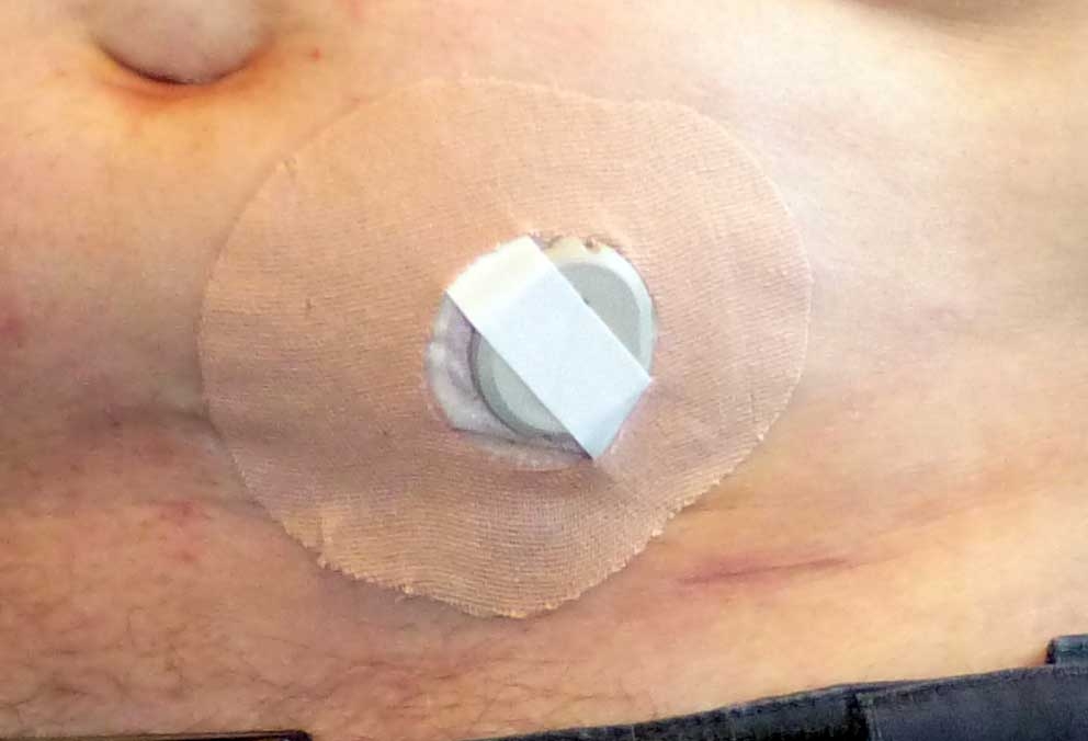dexcdone0535.jpg