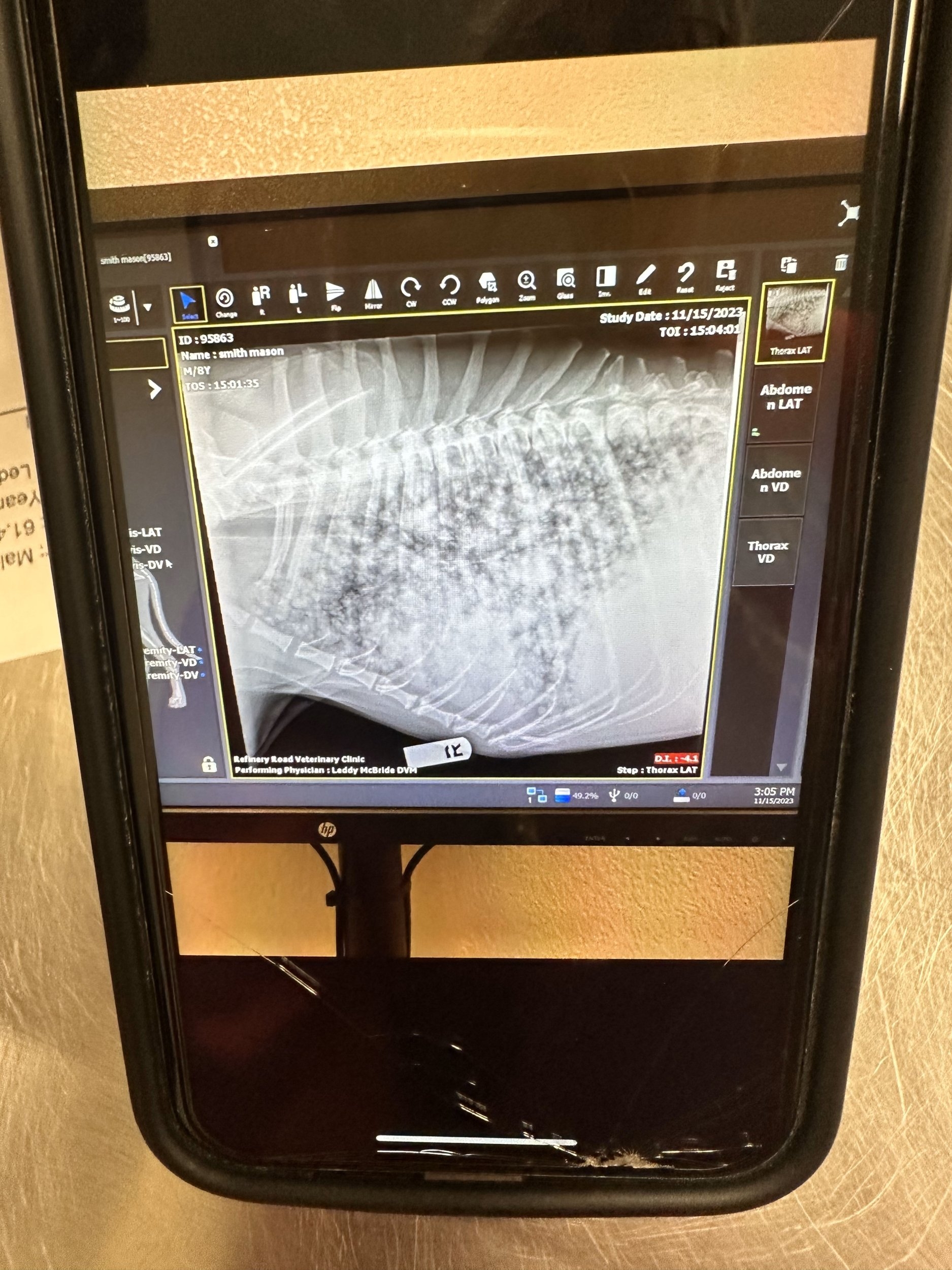 Mason xray.jpg