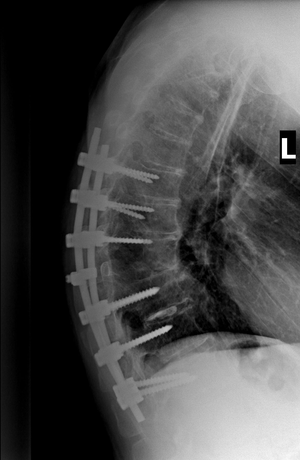xray1.jpg
