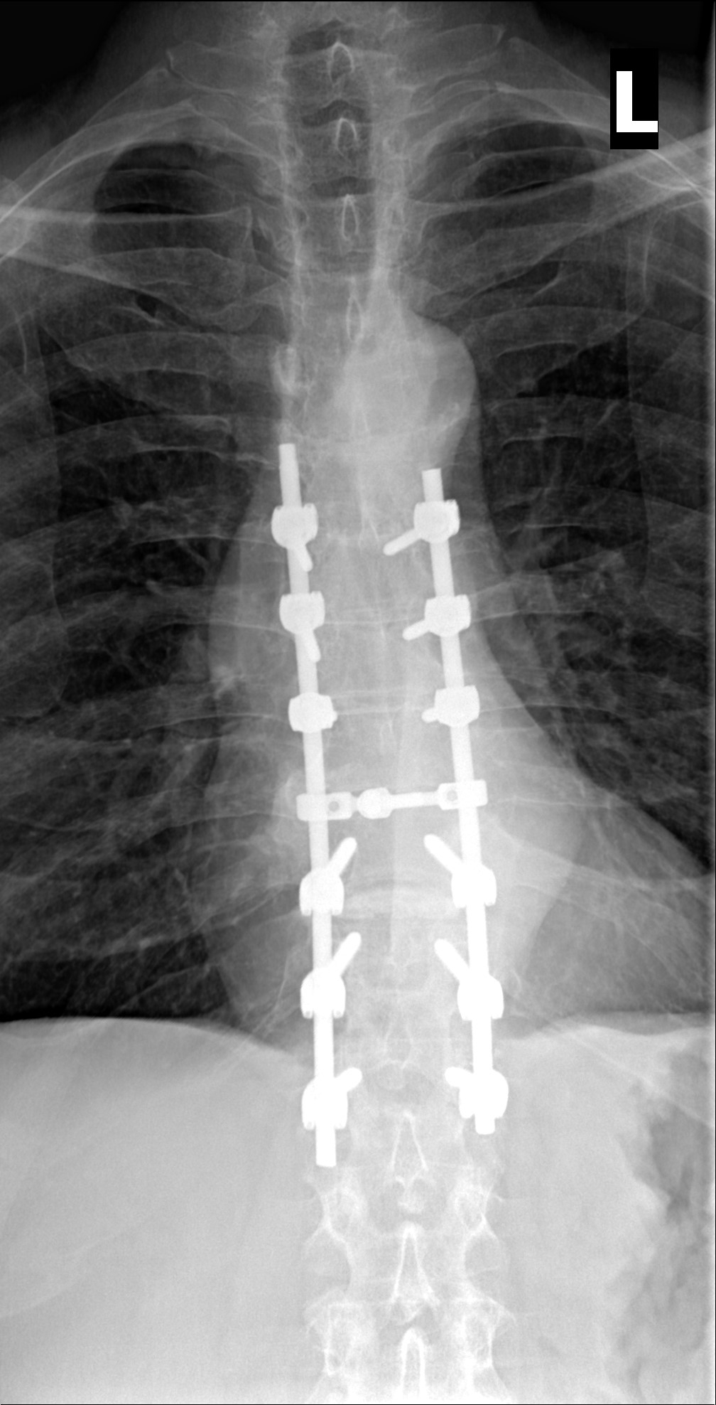 xray2[5913].jpeg