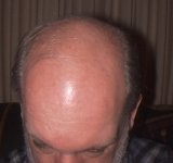 35-99820-hair.JPG