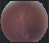 My Eye 3-18-2008 75 DPI 30 B.jpg