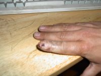 Bad Motor Finger 002.jpg