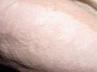 6-137749-armclosea.jpg