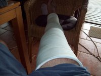 leg.jpg