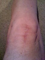 my knee.jpg