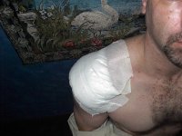 405571-Shoulder 2.jpg