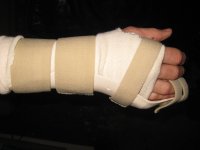 hand.JPG