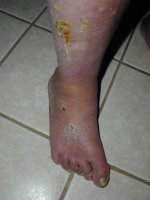 Bob's Condition 2011-23.jpg