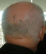 500008-Lawn mower in hair.jpg