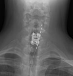 neck_zpse6ba4f88.jpg neck_zpse6ba4f88.jpg