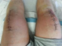 DoubleKnee.jpg