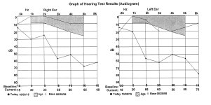 Audiogram.jpg