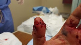 20151106_195307.jpg