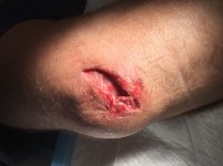 MX Crash.jpg