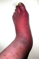 L FOOT.jpg