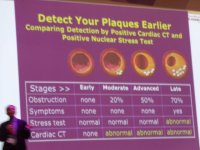 cardiac CT vs. stress test.jpg