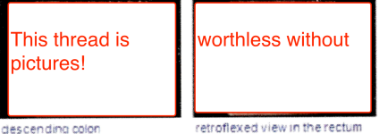 NP.png