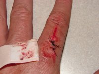finger.JPG